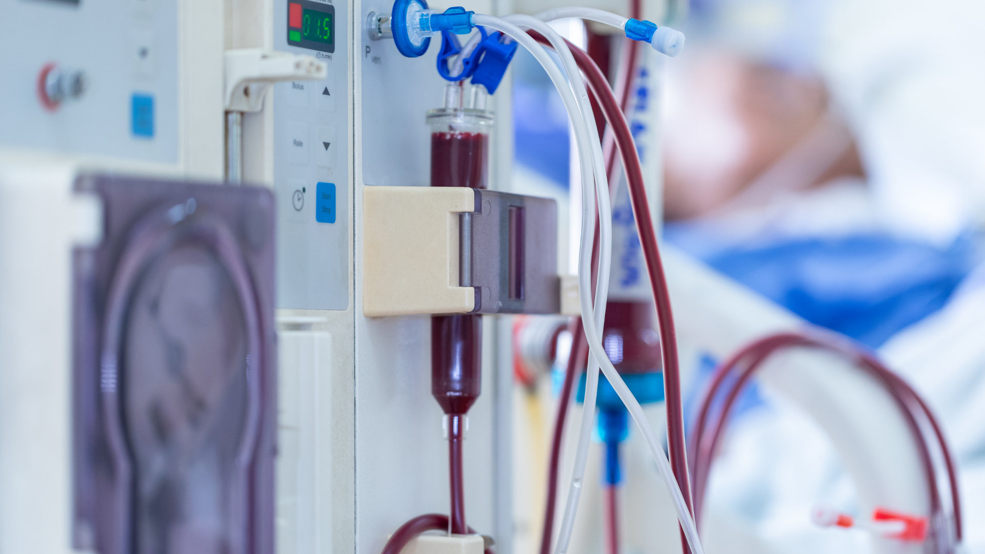 Điều trị thận yếu phụ thuộc vào nguyên nhân gây ra cơn đau, từ việc dùng thuốc đến các biện pháp thay đổi lối sống