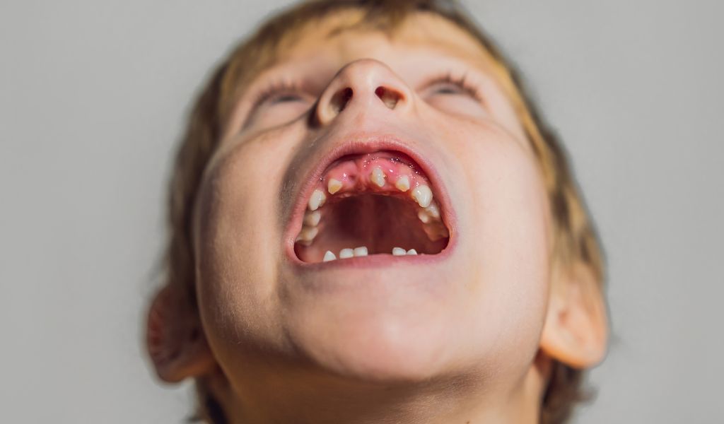 Trẻ bị dính thắng lưỡi có nói được không? 1