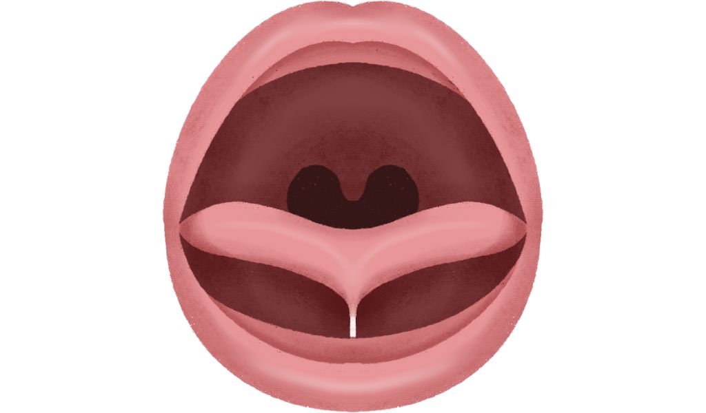 Trẻ bị dính thắng lưỡi có nói được không? 2