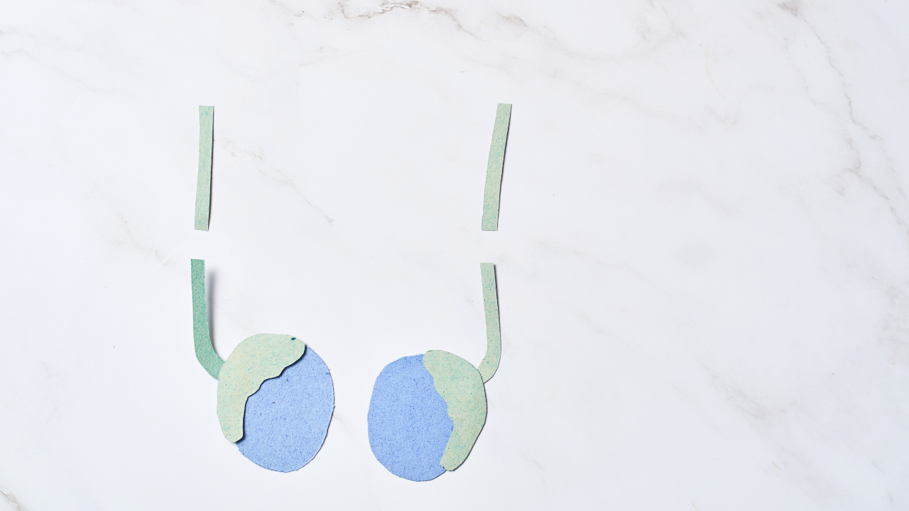 Vasoepididymostomy là kỹ thuật nối ống dẫn tinh trực tiếp với mào tinh