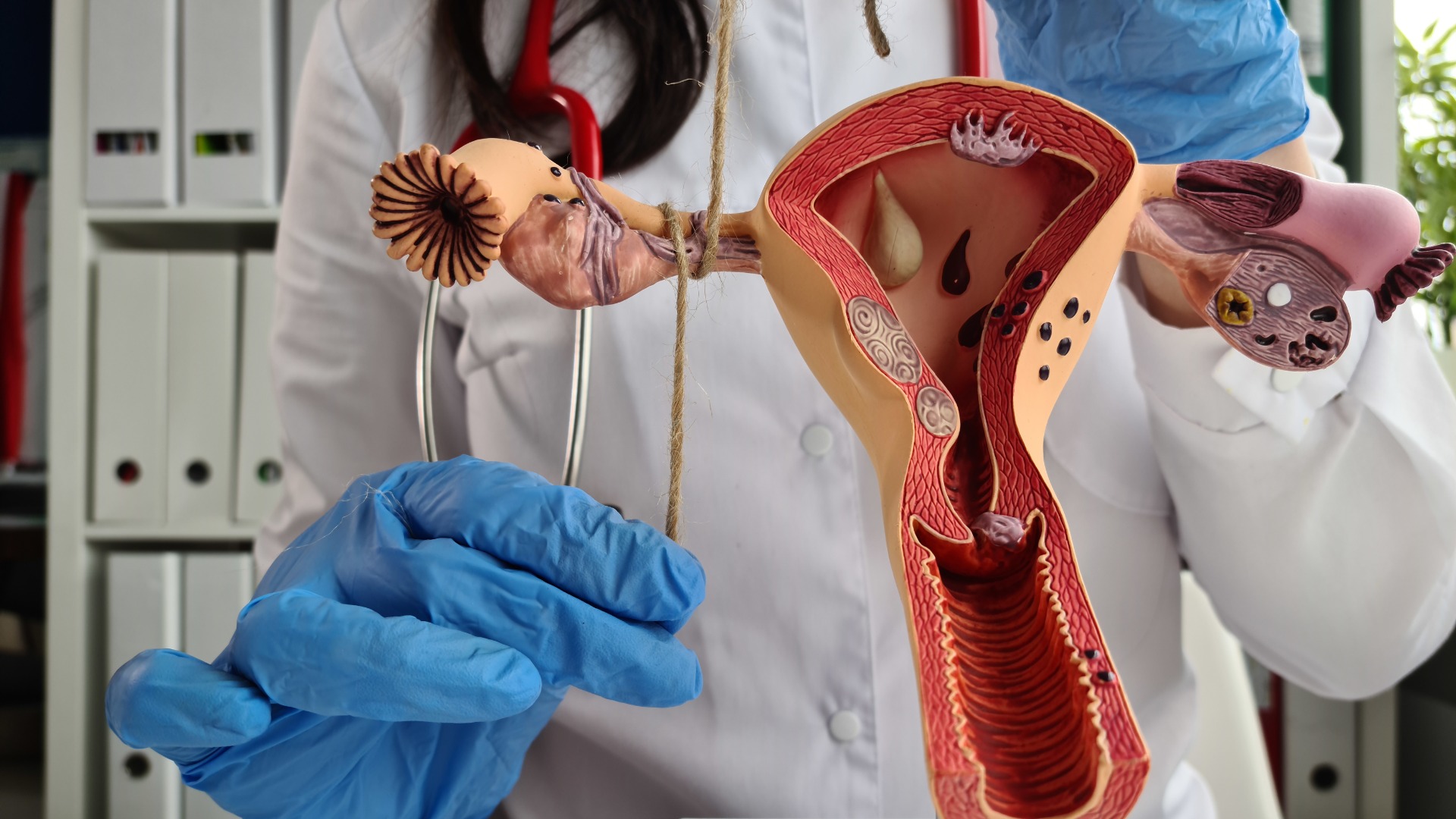 Thắt ống dẫn trứng là phương pháp tránh thai có hiệu quả cao hiện nay