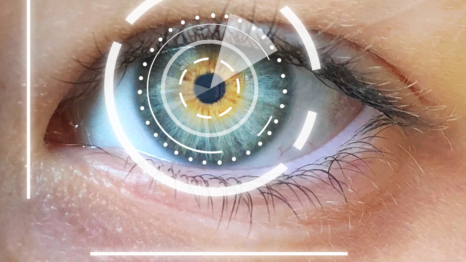 Các tật khúc xạ ở mắt