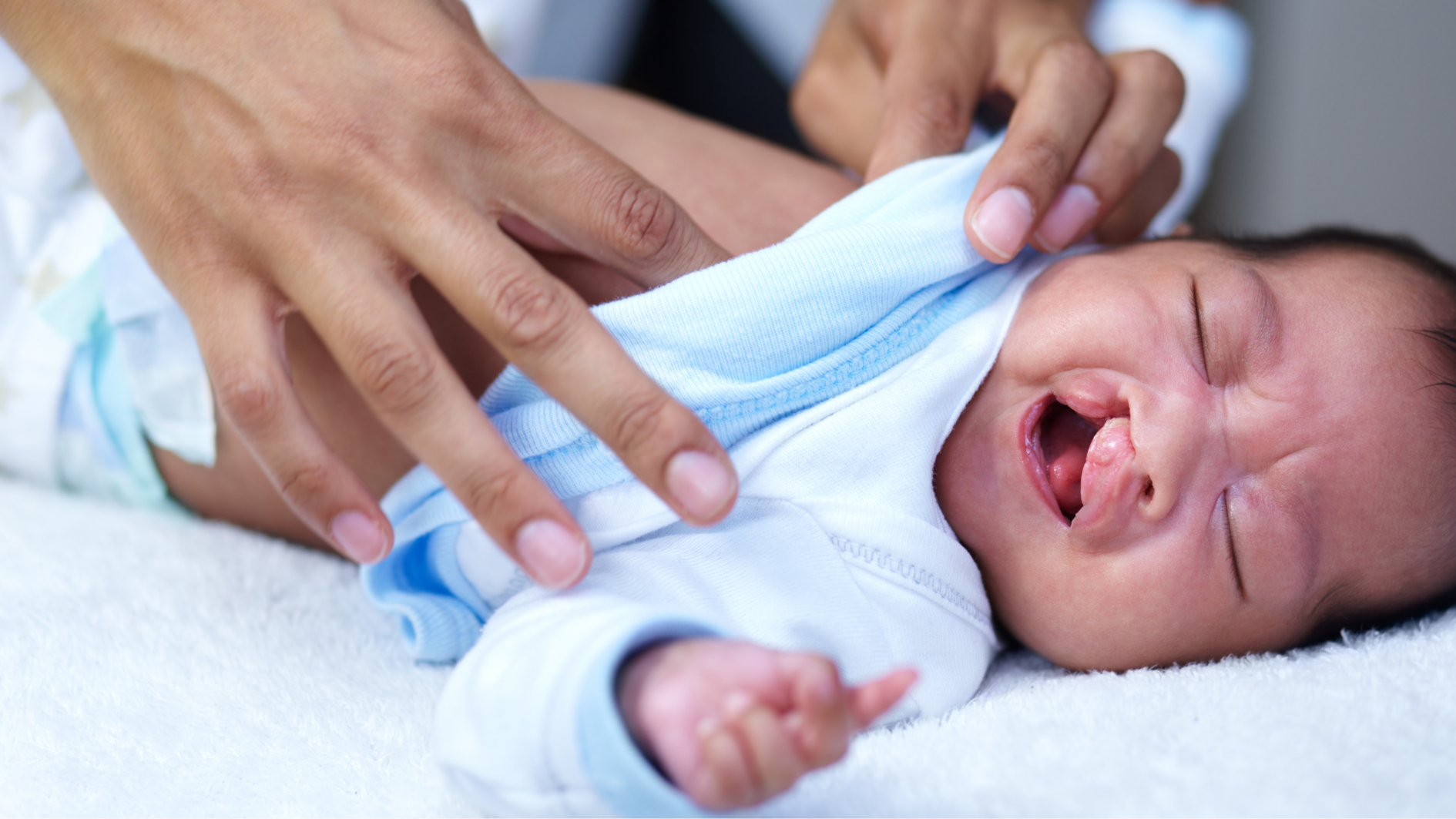 Dị tật sứt môi, hở hàm ếch có thể khiến người bệnh phải thở bằng miệng