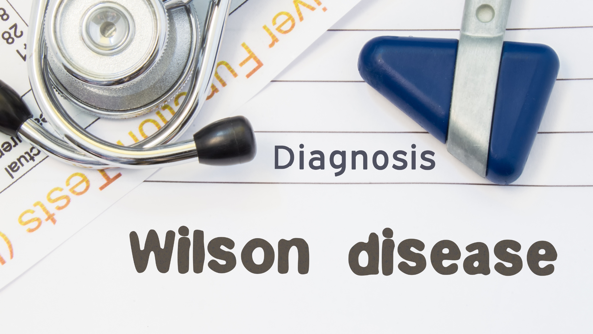 Bệnh Wilson cũng có thể ảnh hưởng đến khớp, làm tăng nguy cơ thoái hóa ở người trẻ tuổi