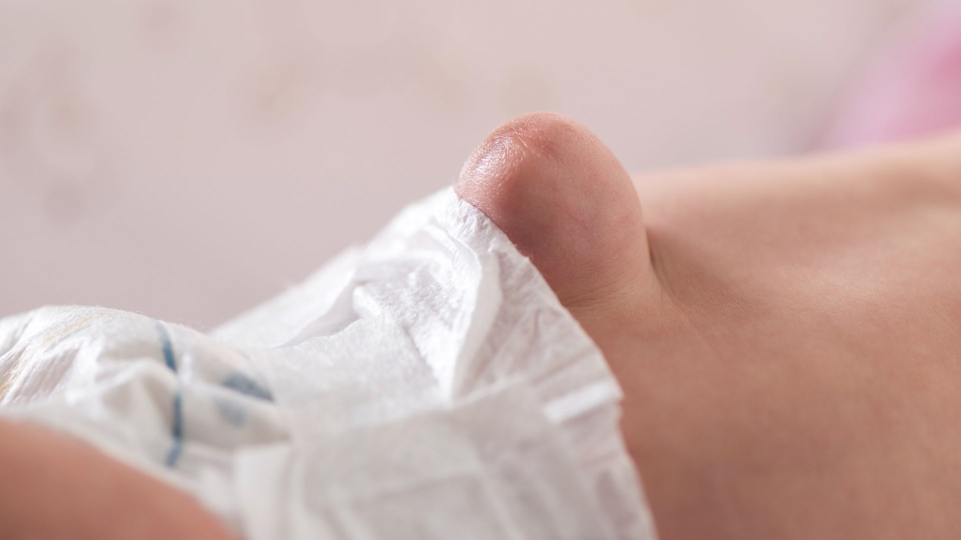 Thoát vị rốn thai nhi là một dạng dị tật bẩm sinh xảy ra không phổ biến