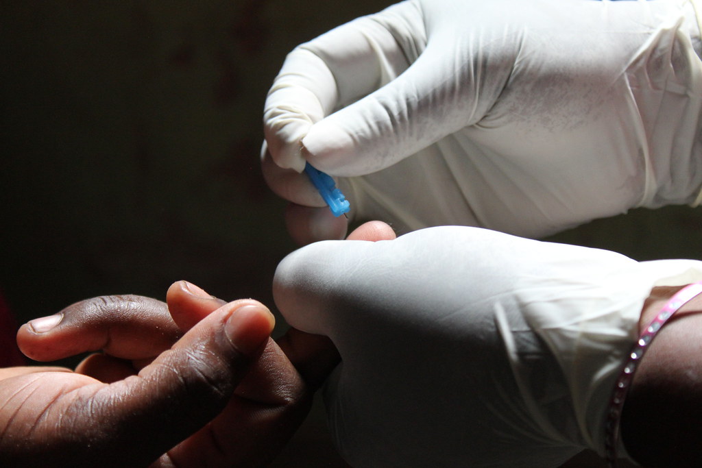 Thời điểm xét nghiệm HIV có kết quả chính xác là khi nào? Ai cần xét nghiệm HIV? 4