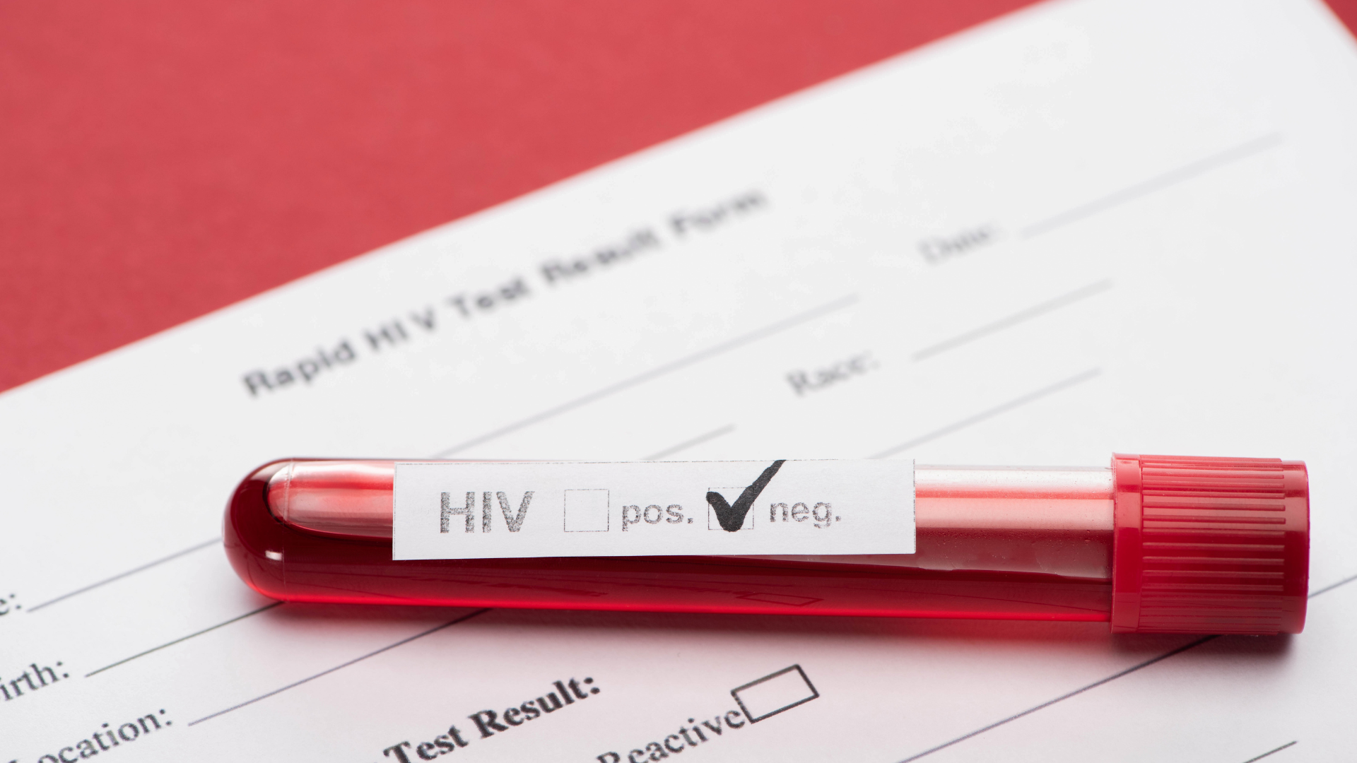 Có rất nhiều yếu tố khác nhau như quy trình, số lượng mẫu,... có thể ảnh hưởng tới thời gian trả kết quả xét nghiệm HIV