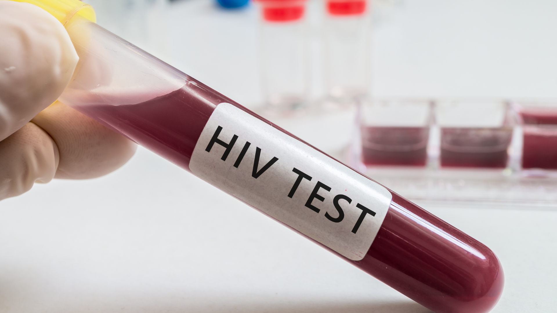 Tham khảo ý kiến bác sĩ để sử dụng các biện pháp dự phòng khi cần thiết