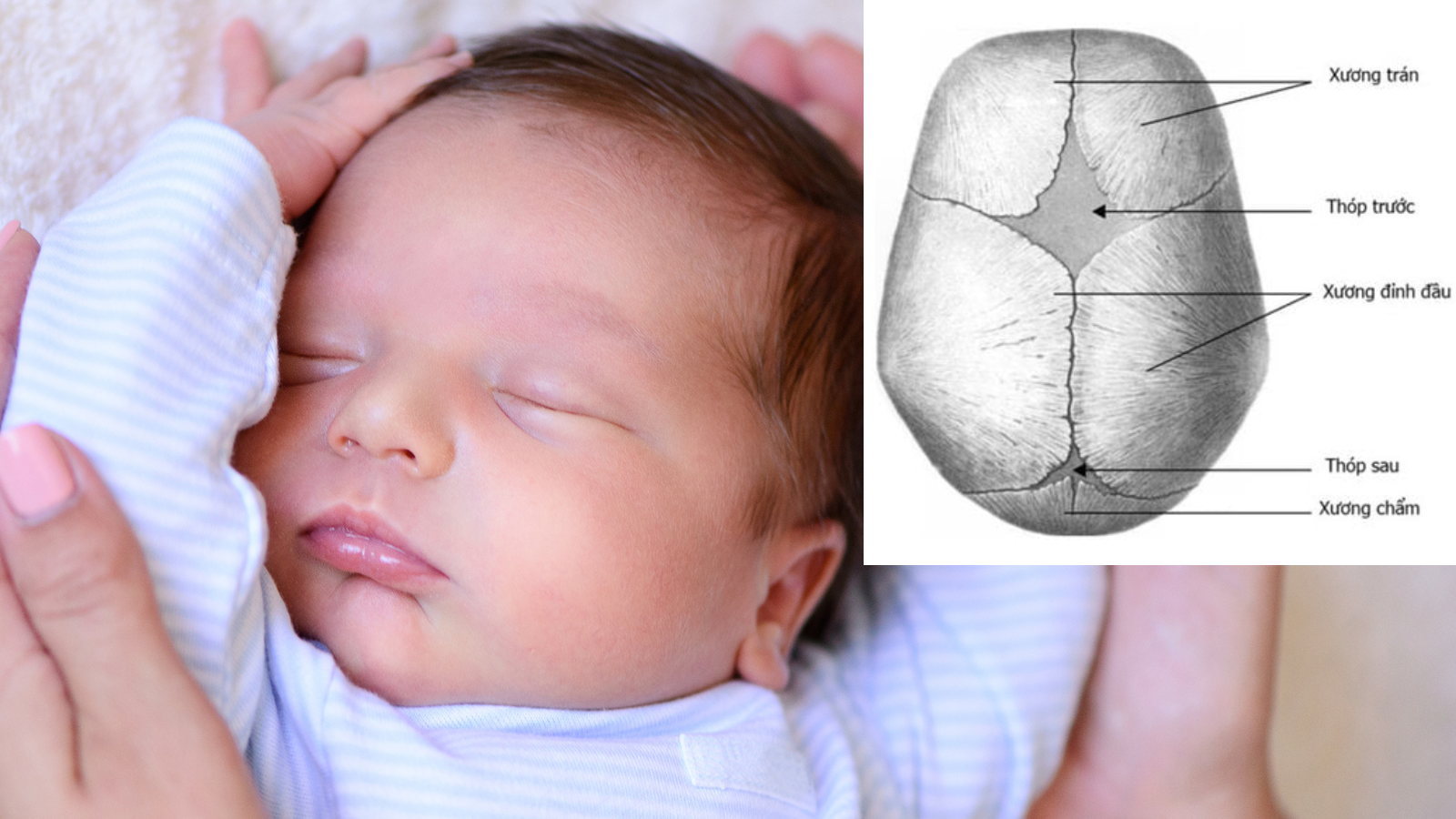Hai thóp chính ở trẻ là thóp trước và thóp sau