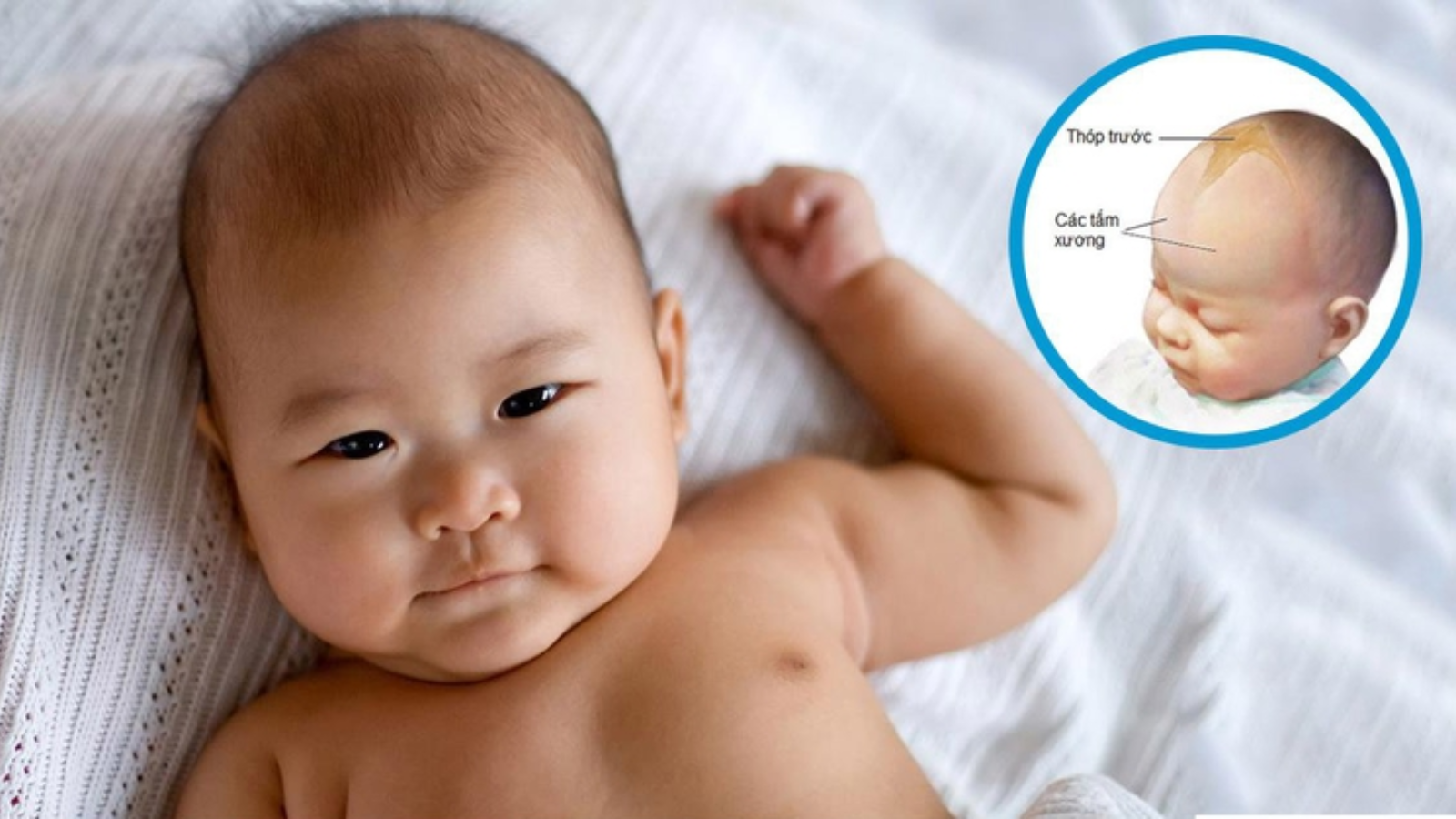 Thóp trẻ sơ sinh có chức năng gì? Những thông tin quan trọng ba mẹ cần biết 2