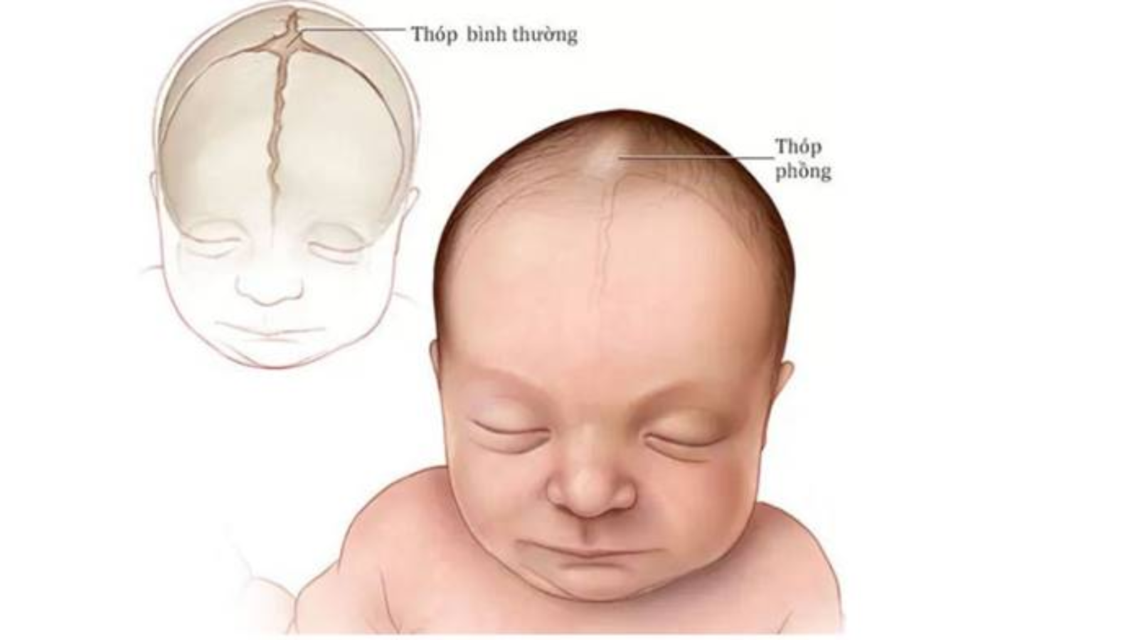 Thóp trẻ sơ sinh có chức năng gì? Những thông tin quan trọng ba mẹ cần biết 3