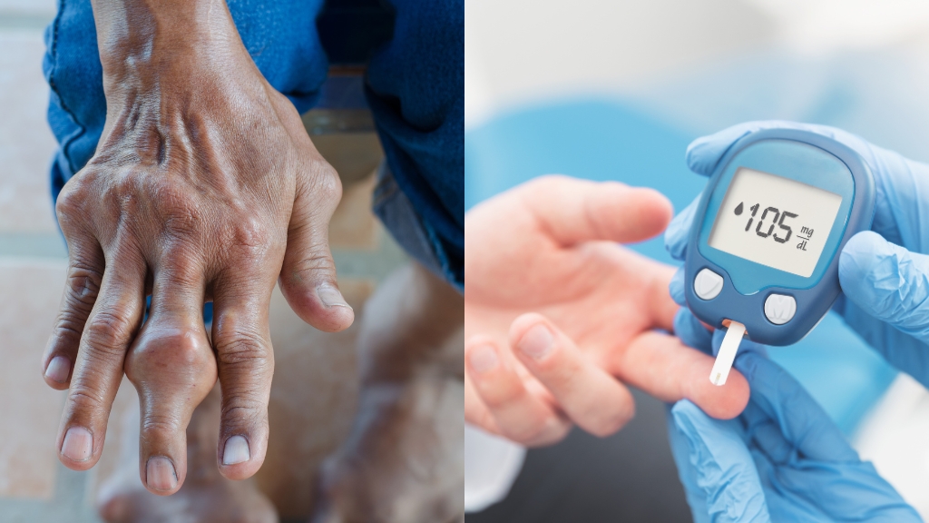 Thực đơn cho người bệnh gout và tiểu đường được xây dựng theo nguyên tắc như thế nào?