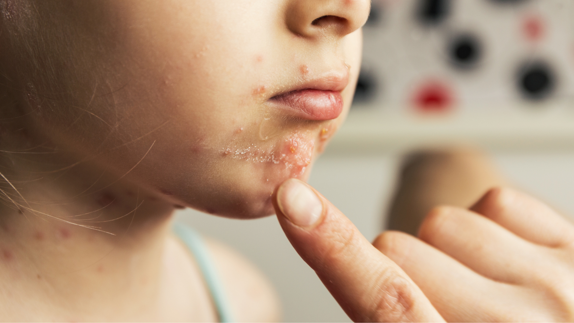 thuy-dau-co-duoc-tam-khong (1).png