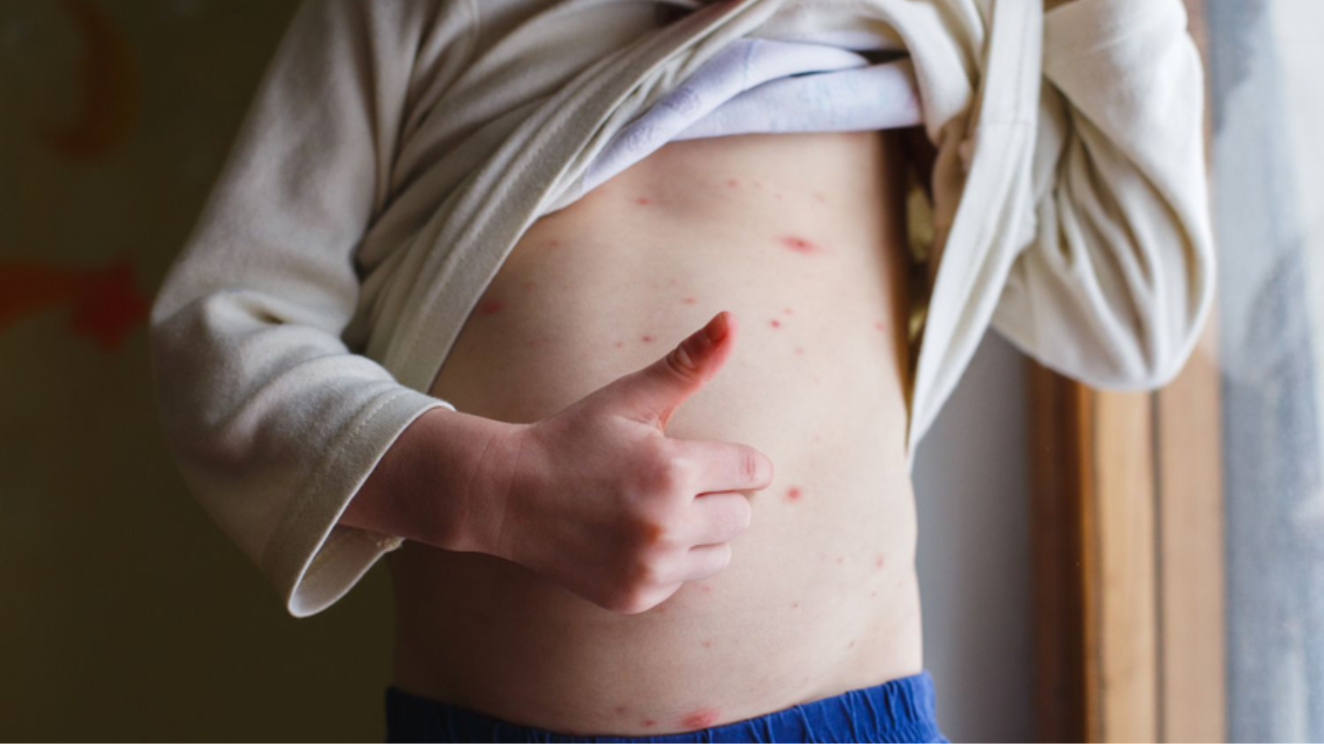 thuy-dau-co-ngua-khong-cam-giac-ngua-keo-dai-bao-lau-va-cach-lam-diu (1).png