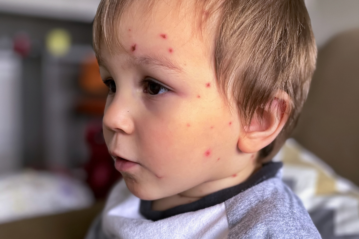 thuy-dau-moi-phat-va-5-dau-hieu-ban-dau-co-the-ban-chua-biet 2.png