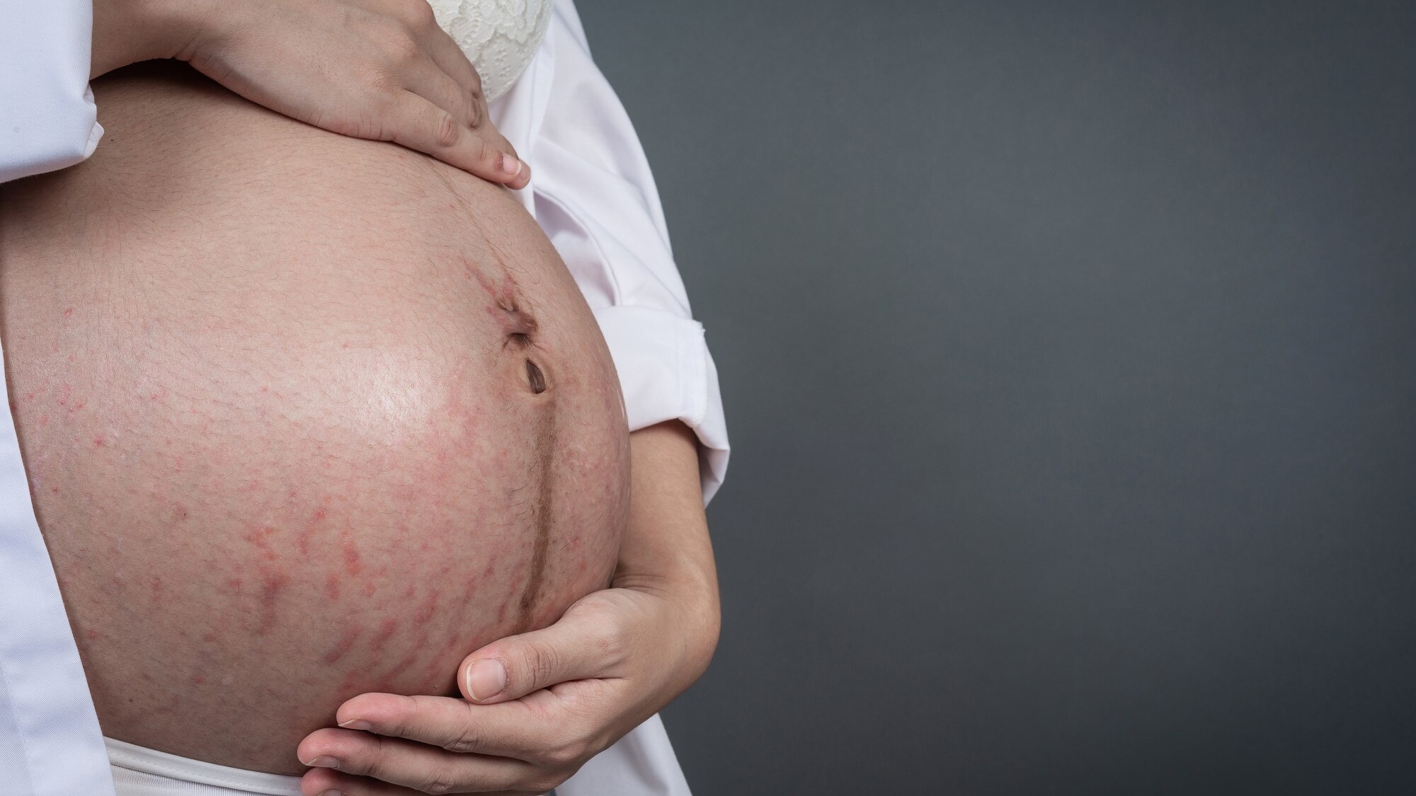 Phụ nữ mang thai mắc thủy đậu người lớn có nguy cơ nguy hiểm