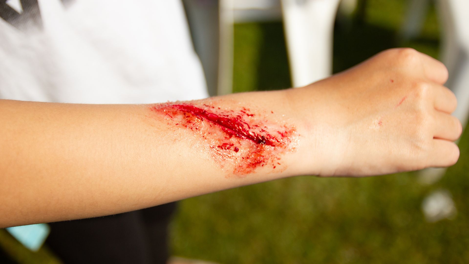 Huyết thanh uốn ván được sử dụng cho người có nguy cơ cao mắc bệnh