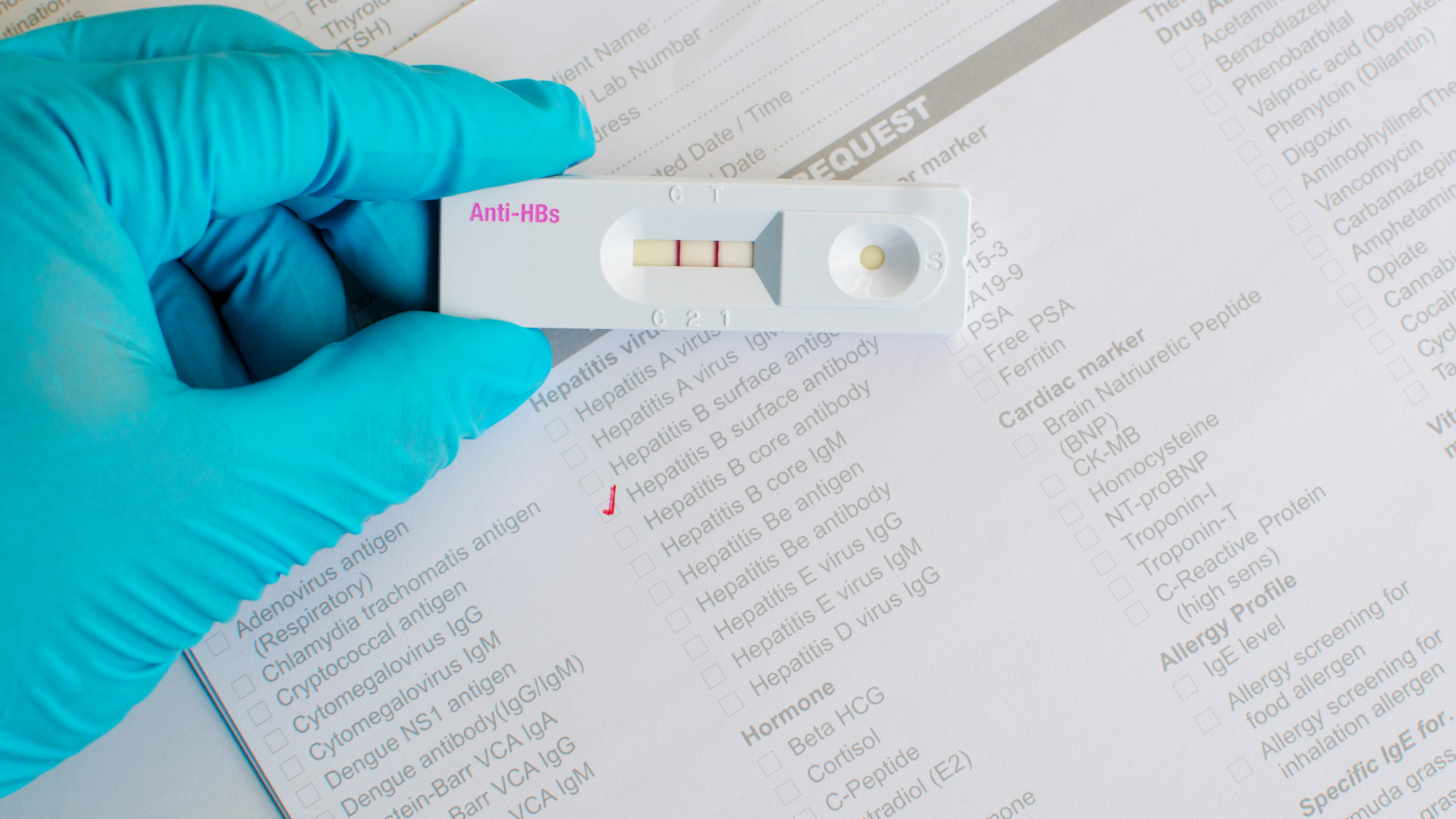 Một số người xét nghiệm thấy Anti HBs dương tính nhưng thật ra kết quả này có thể do từng nhiễm rồi tự khỏi trong quá khứ