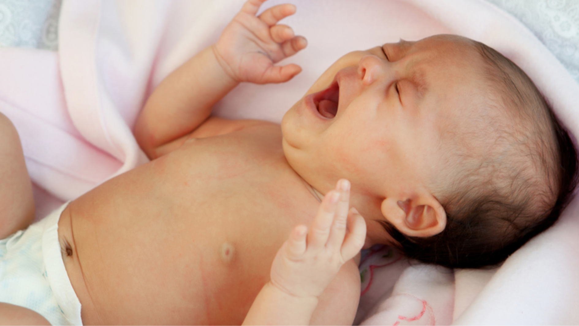 tiem-soi-quai-bi-rubella-cho-be-9-thang-tuoi-duoc-chua (3).png