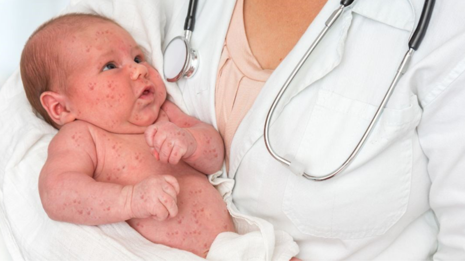 tiem-soi-quai-bi-rubella-cho-phu-nu-co-quan-trong-khong-nen-tiem-khi-nao (4).png