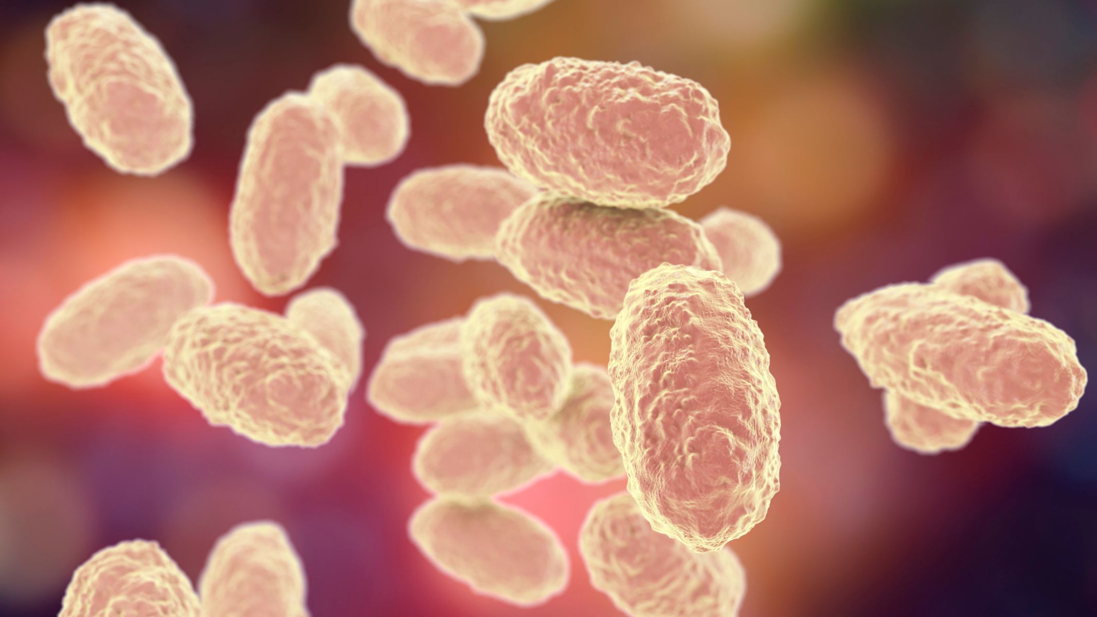 Bạch hầu là bệnh nhiễm trùng cấp tính do vi khuẩn Corynebacterium diphtheriae gây ra