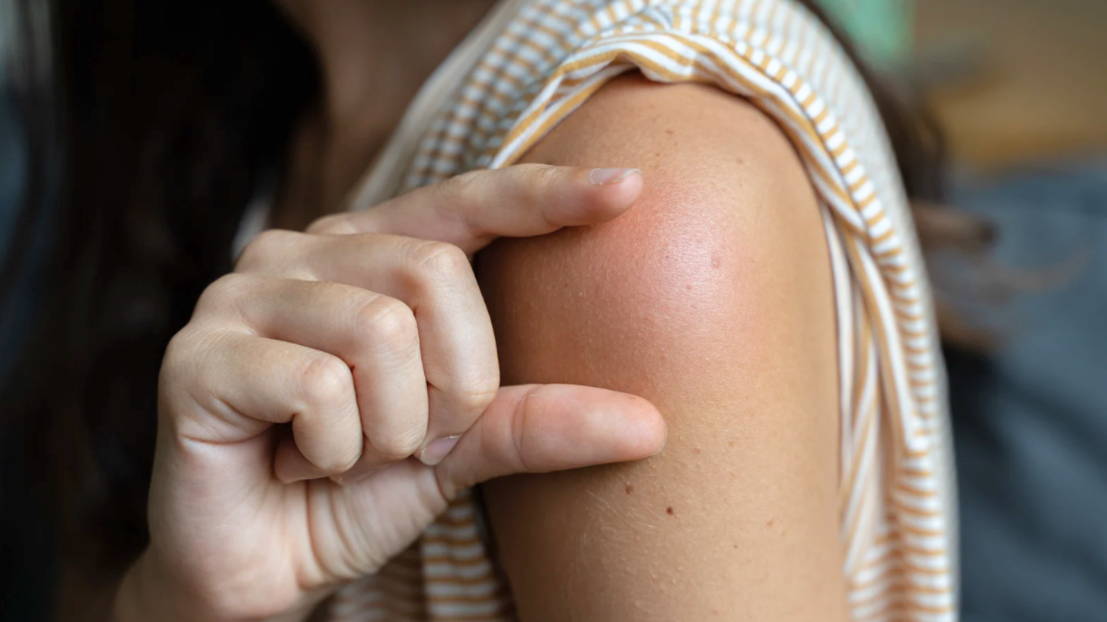 Tiêm vắc xin phế cầu 20 bao nhiêu mũi? 4