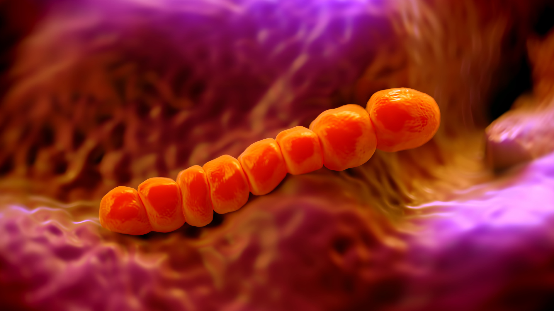 Phế cầu khuẩn gây ra nhiều bệnh nghiêm trọng