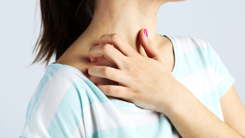 Ngứa tiền mãn kinh thường xuất hiện tại mặt, cổ, da đầu và vùng kín do thay đổi nội tiết tố