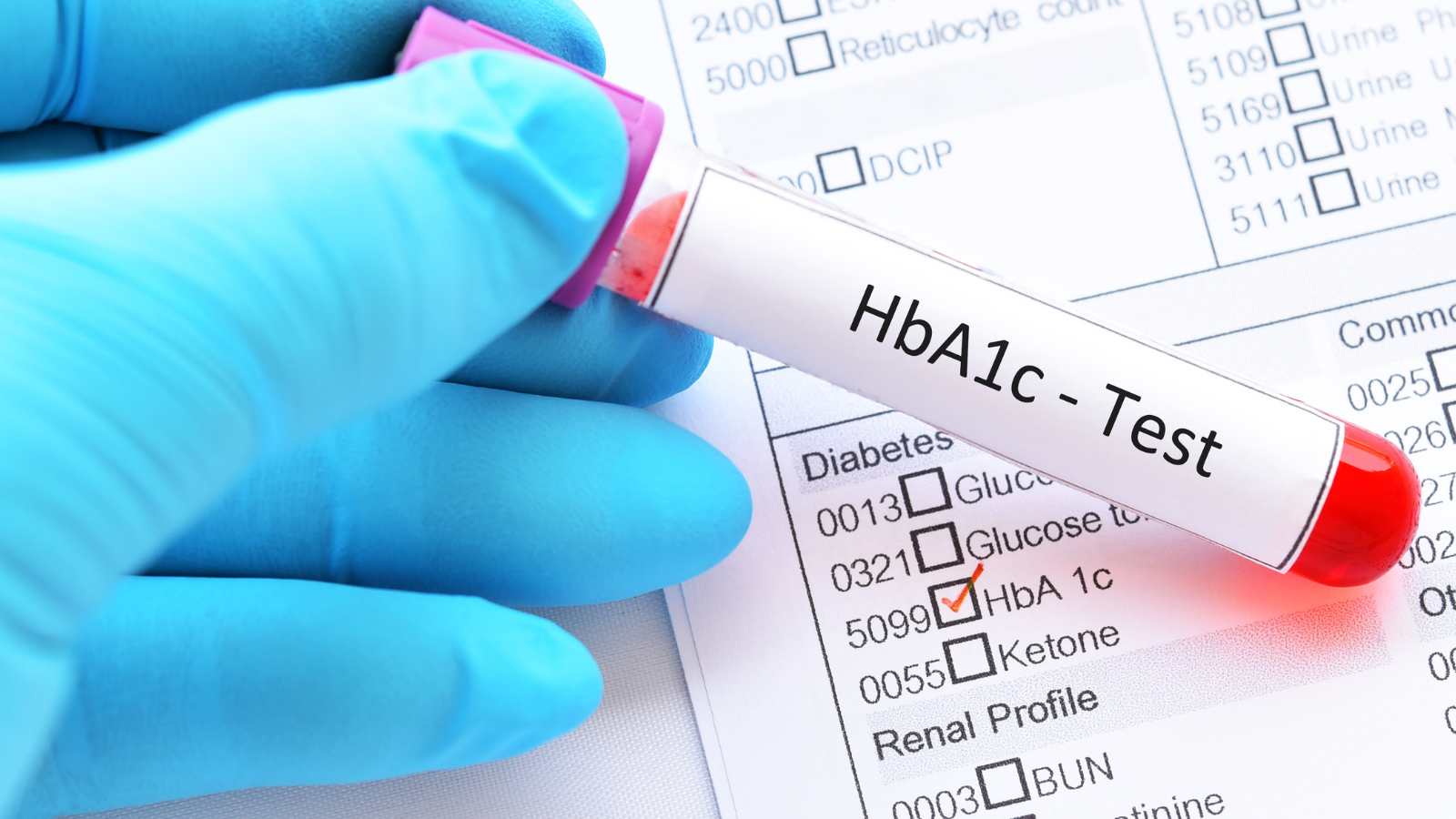 Bác sĩ thường yêu cầu làm xét nghiệm HbA1c