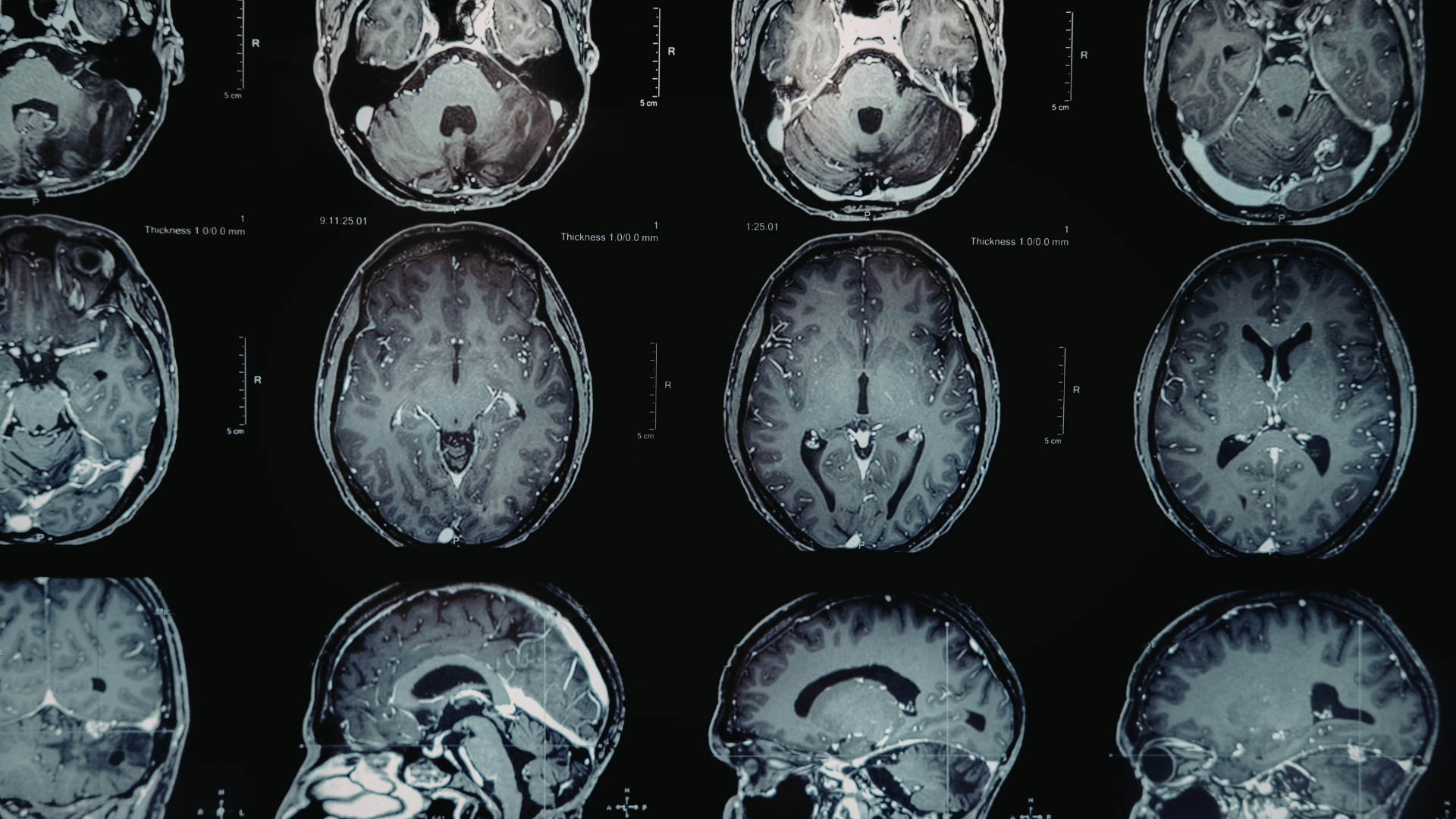 Nhiều loại hình học tập vận động phụ thuộc mạnh mẽ vào hoạt động của tiểu não.