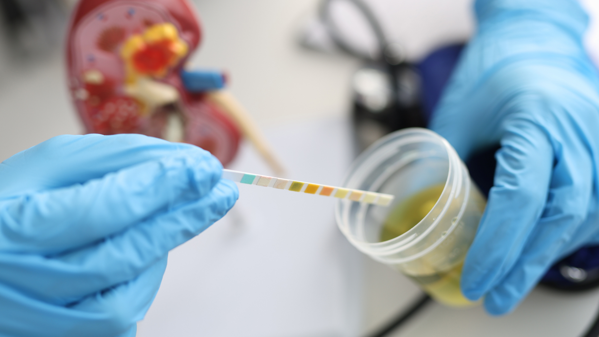 Phân tích nước tiểu bằng que thử