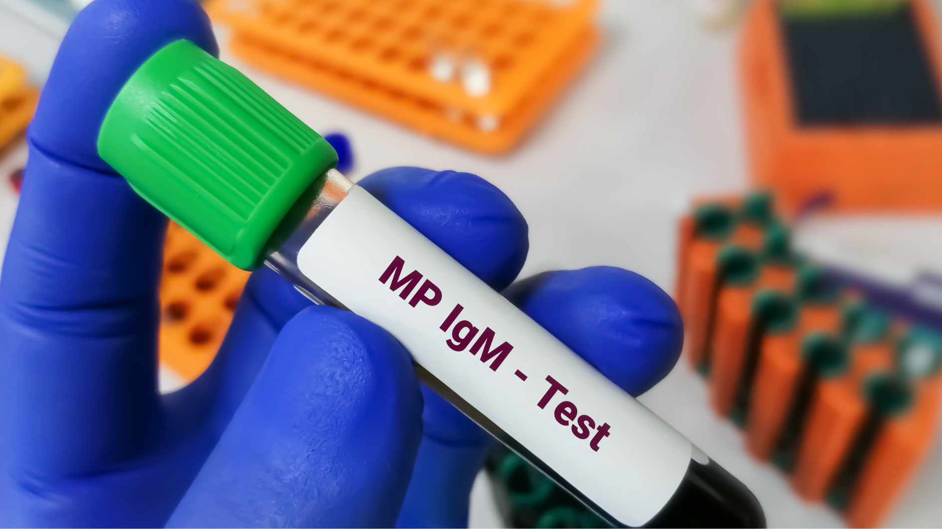 tim-hieu-tam-quan-trong-cua-khang-the-ig-m-trong-he-thong-mien-dich 3.png