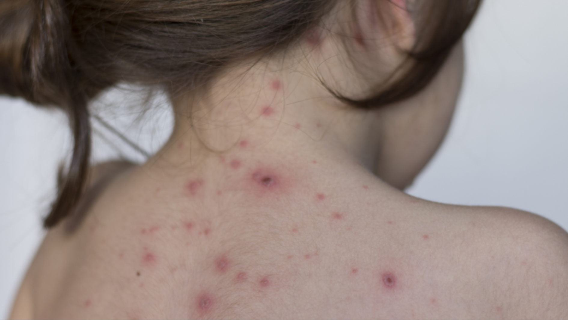 tim-hieu-thuy-dau-co-de-lai-seo-khong-can-luu-y-gi-de-han-che-seo (2).png