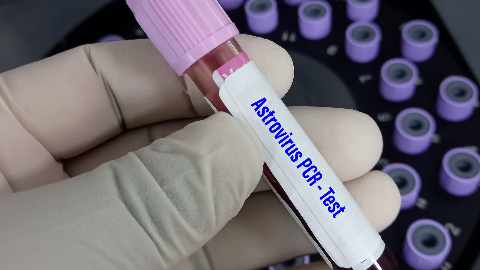 tim-hieu-virus-astrovirus-lay-nhiem-qua-nhung-con-duong-nao-1