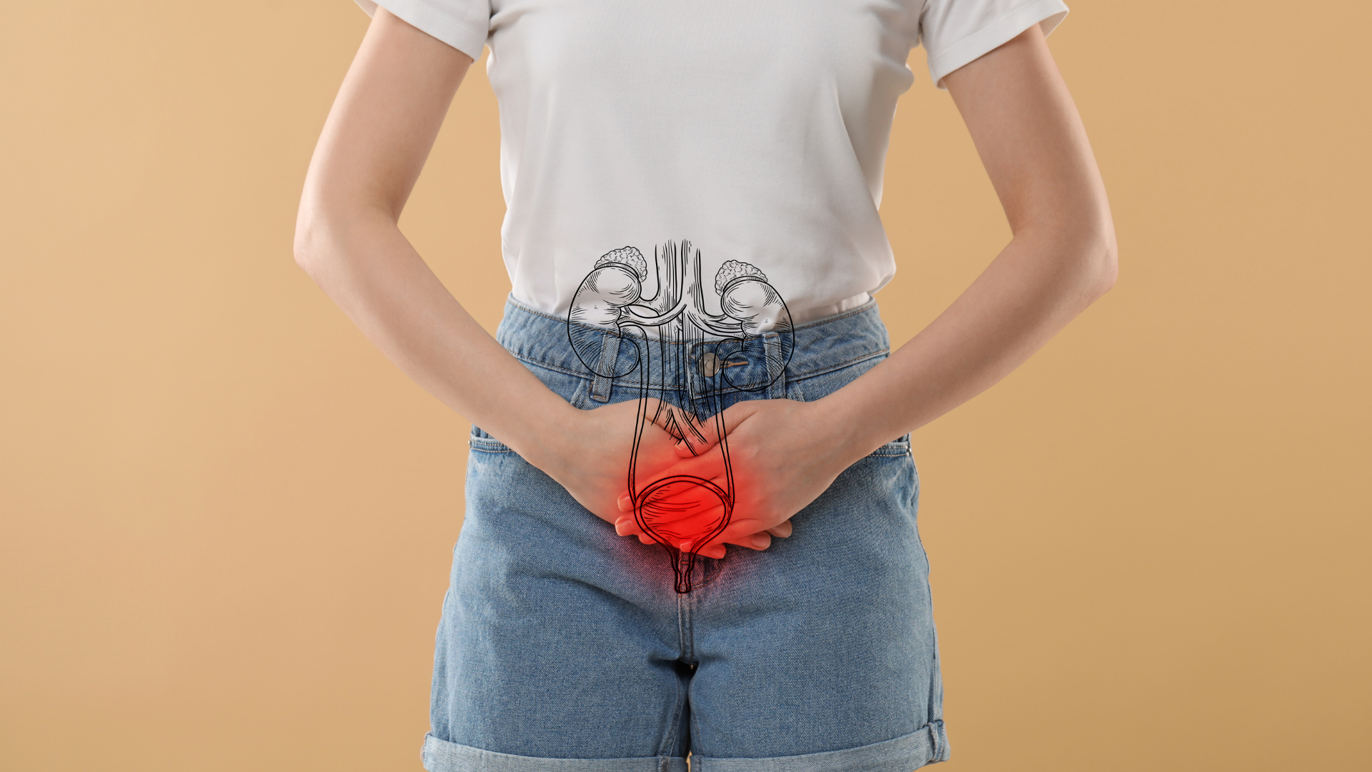 Nhiễm trùng đường tiết niệu cũng là nguyên nhân phổ biến gây viêm bàng quang xuất huyết