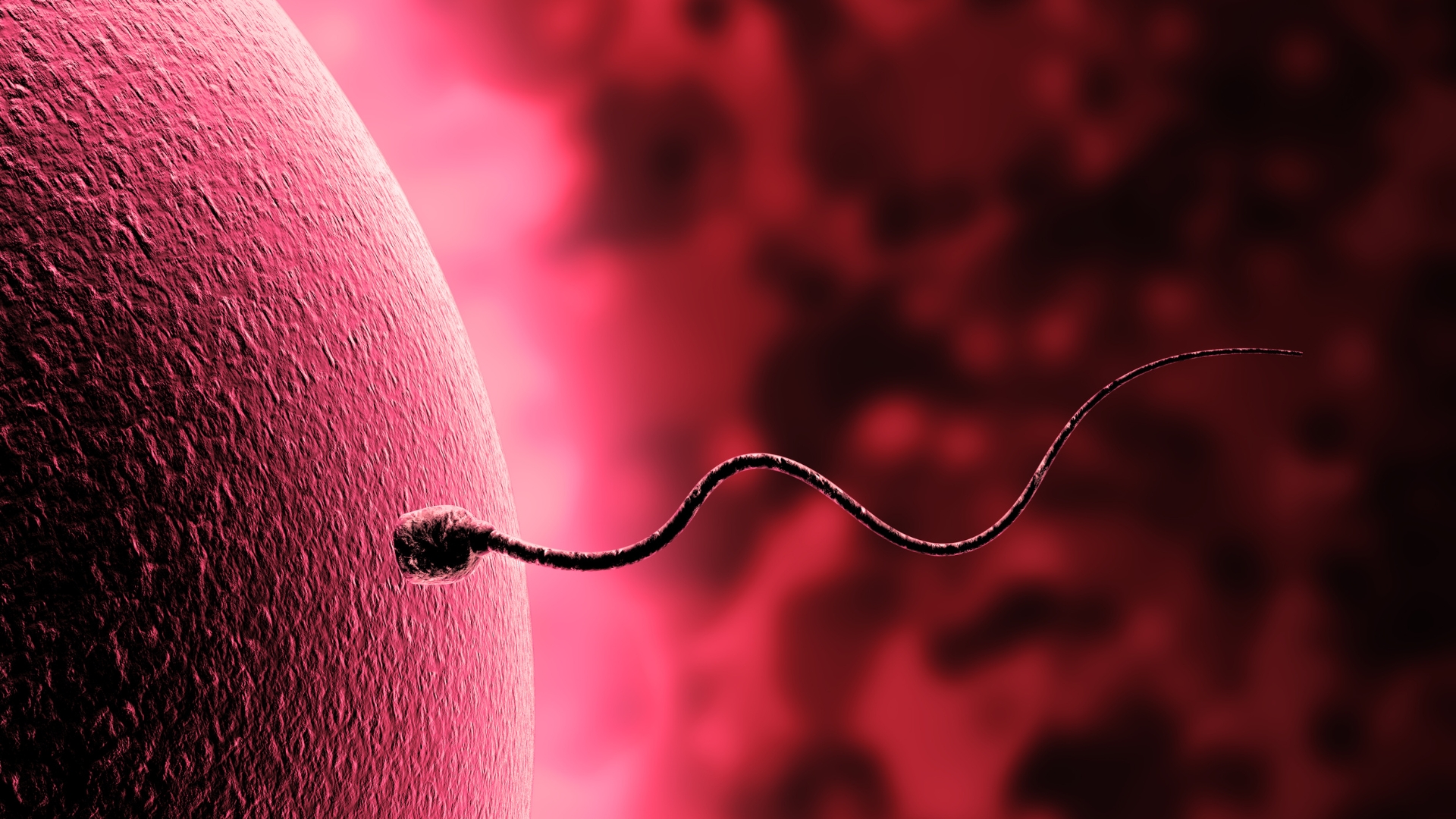 IVF phụ thuộc nhiều yếu tố, trong đó các yếu tố về người vợ chiếm vai trò chủ yếu, kỹ thuật ICSI thường được áp dụng với tinh trùng dị dạng