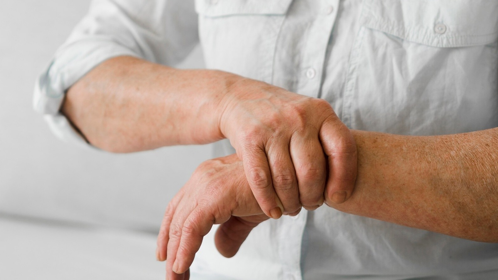 Tổn thương dây thần kinh quay có thể gây mất chức năng vận động nếu không được chẩn đoán và điều trị kịp thời