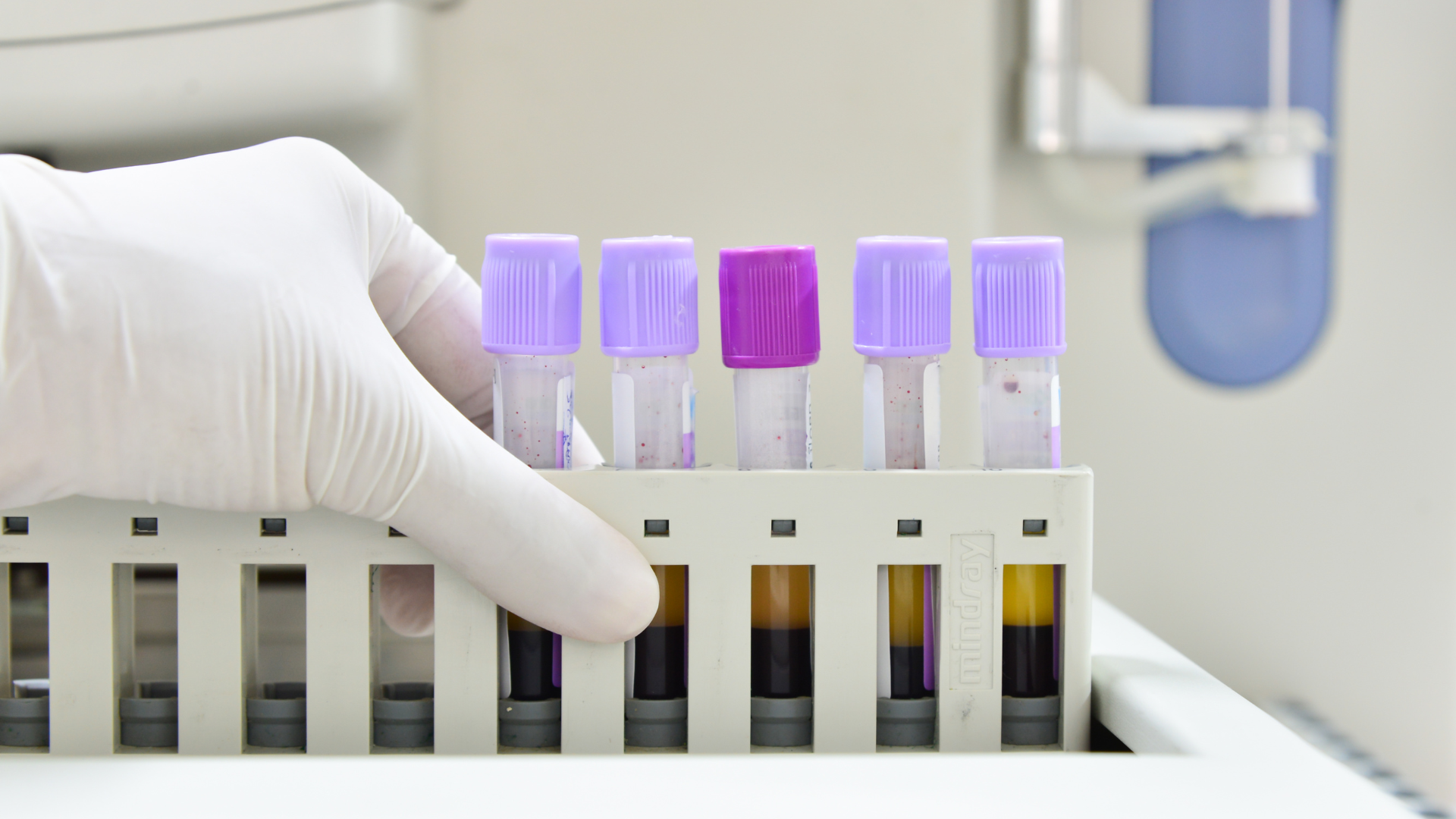 Tuân thủ đúng hướng dẫn trước khi làm xét nghiệm sẽ giúp kết quả phản ánh chính xác tình trạng sức khỏe