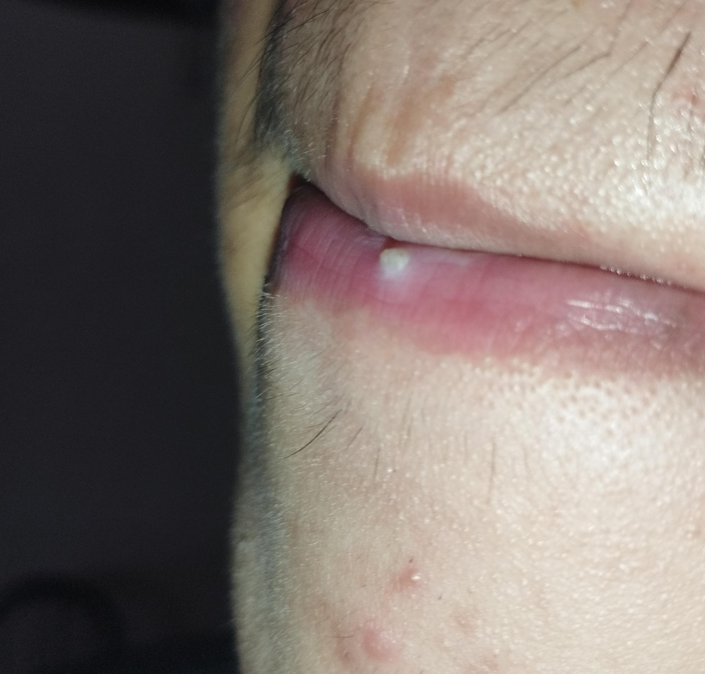 tong-quan-ve-sui-mao-ga-o-moi-5