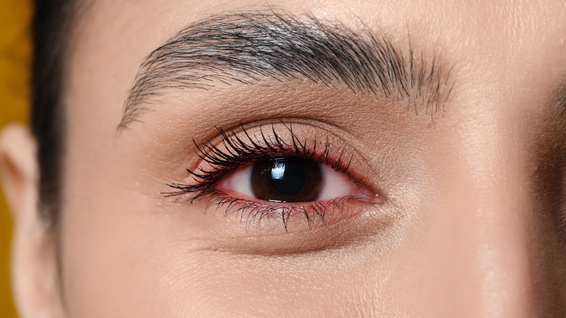 Thoái hóa điểm vàng là bệnh lý ảnh hưởng đến vùng trung tâm võng mạc