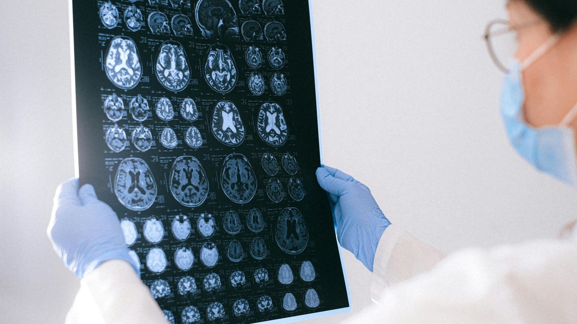 Rối loạn trục hạ đồi - tuyến yên có thể gây trầm cảm