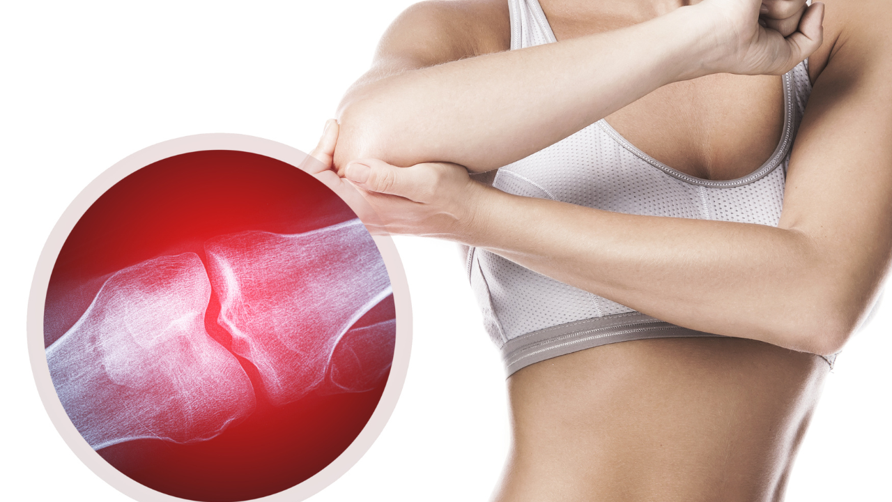 Tràn dịch khớp khuỷu tay gây tích tụ dịch bất thường trong ổ khớp