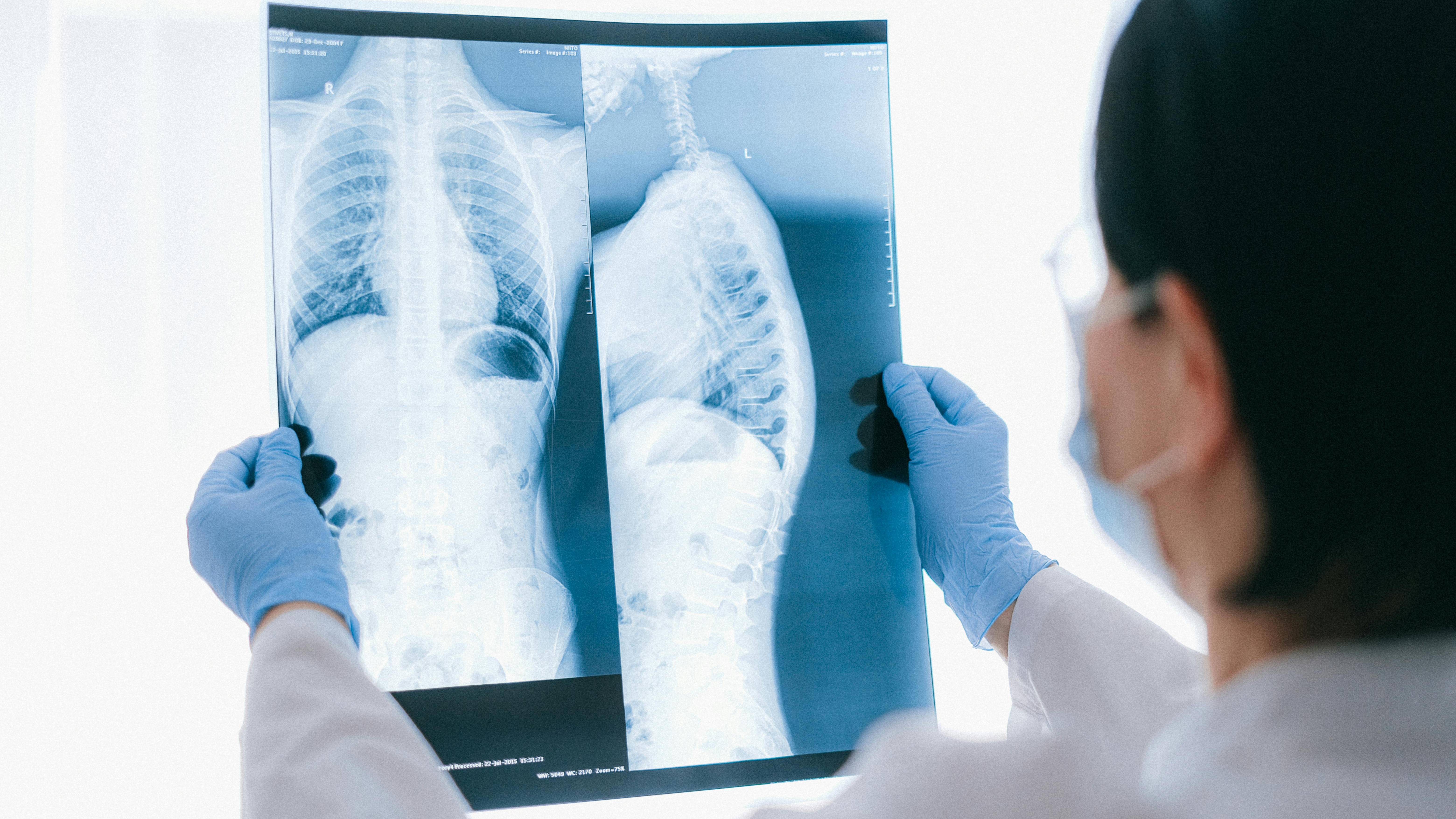 Nếu liên quan đến bệnh lý mạn tính hoặc ác tính, thời gian điều trị có thể kéo dài hơn