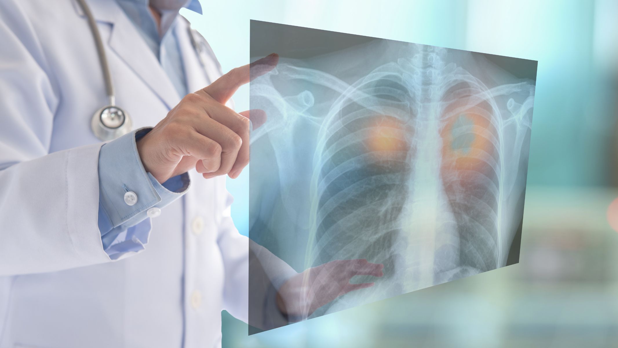 Tràn máu màng phổi có nguy hiểm không? Triệu chứng và cách điều trị 4