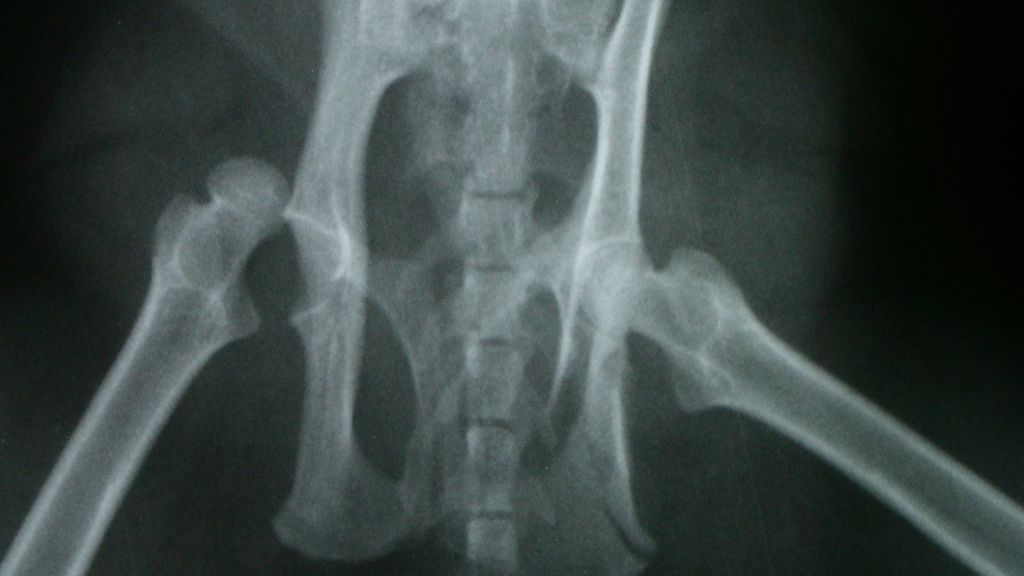 Trật khớp háng bẩm sinh là tình trạng trẻ có khớp háng không ổn định ngay từ giai đoạn bào thai