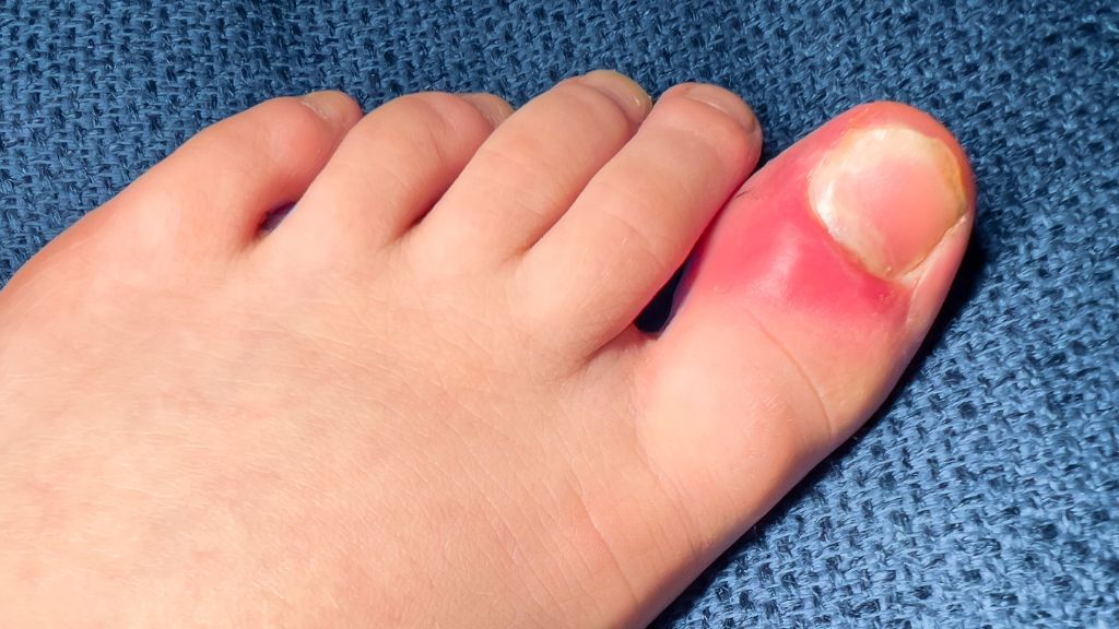 Khi không chắc chắn về tình trạng chấn thương, tốt nhất nên đến cơ sở y tế để được kiểm tra đúng chuyên môn