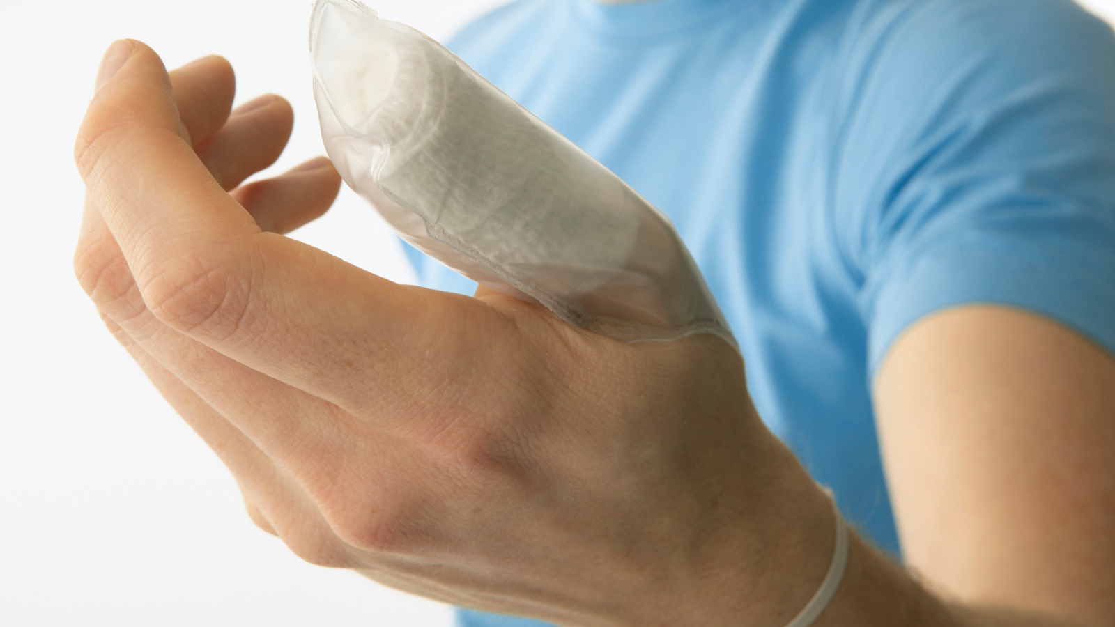 Ngón tay cái cần được cố định bằng nẹp hoặc băng chuyên dụng trong khoảng 2 - 4 tuần