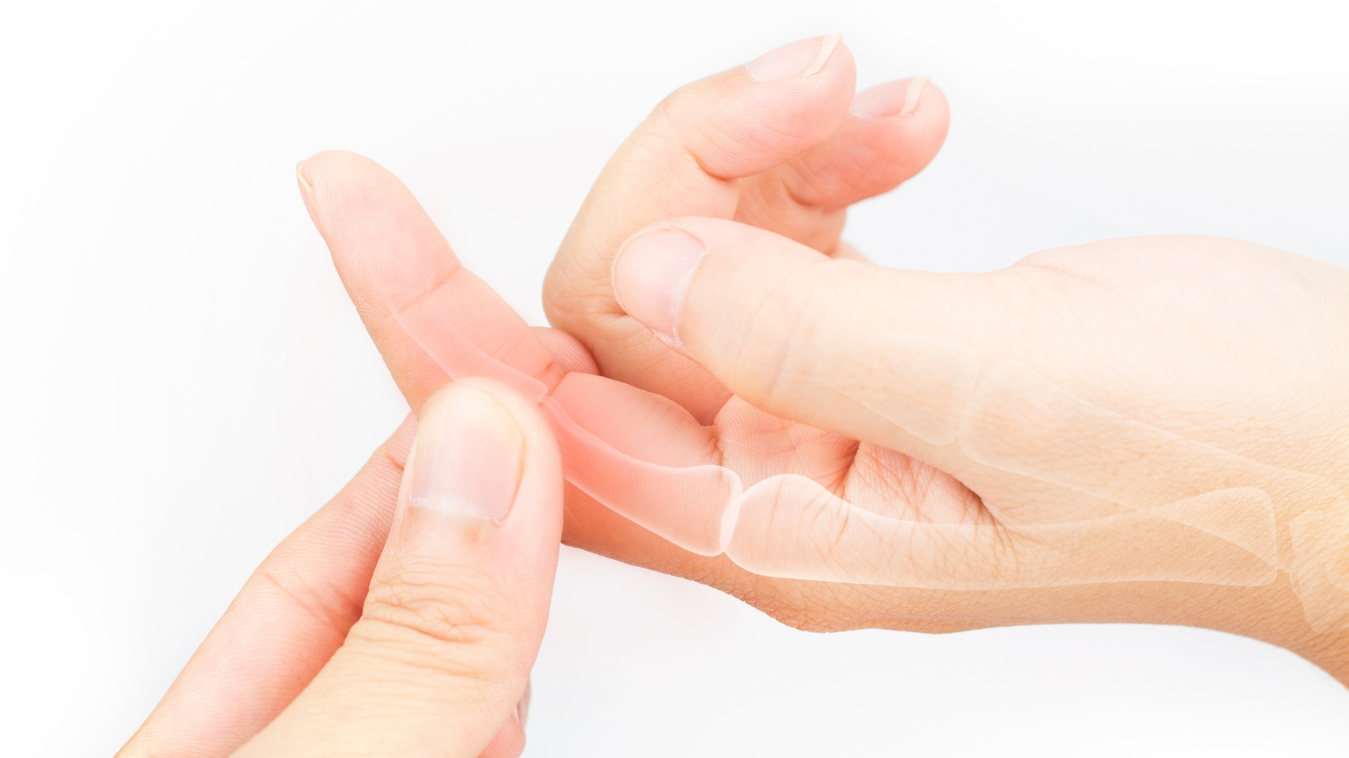 Trật khớp ngón tay là một dạng chấn thương khá phổ biến và không nên xem nhẹ