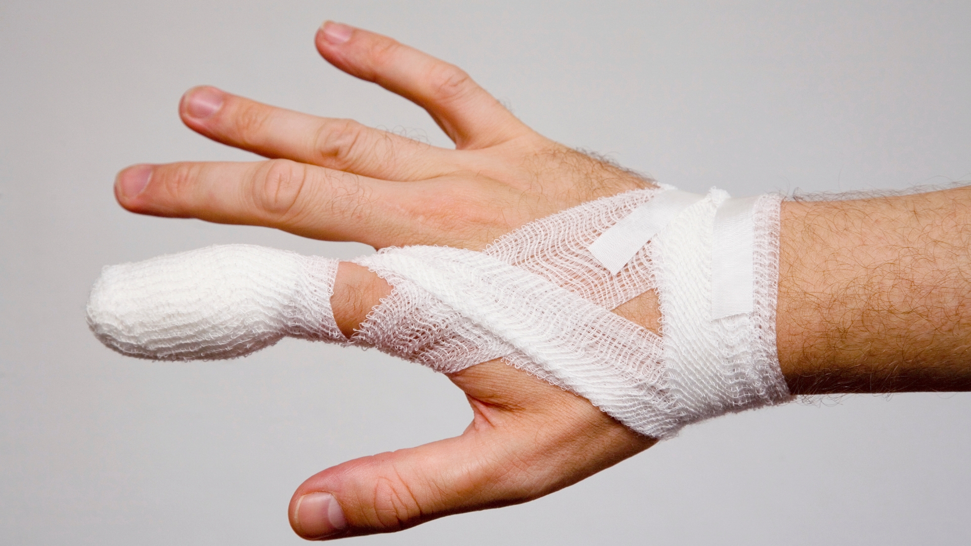 Người bệnh có thể cần cố định khớp, nghỉ ngơi và phục hồi chức năng theo hướng dẫn chuyên môn