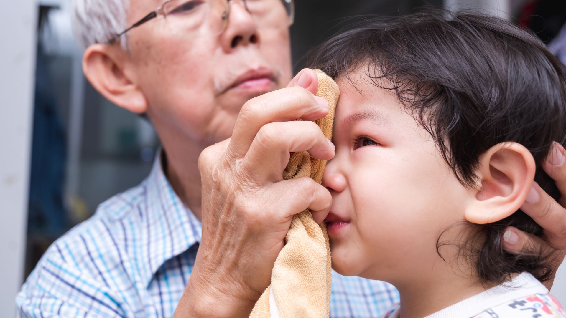 Nhiều phụ huynh thắc mắc trẻ bị té u trán phải làm sao
